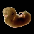 Embryo 